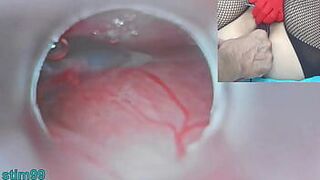 Japanese Insemination with Cum into Uterus and Endoscope Camera by Cervix to watch inside womb Uncensored - porn video