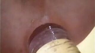 Fisting with a huge bottle until a prolapse comes out - porn video